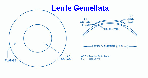 Gemellata